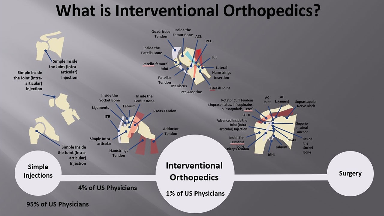 Interventional Orthopedics Diagram