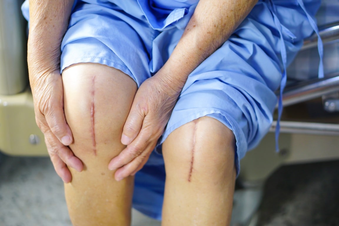 Accelerating Post-Surgical Healing with MLS Laser Therapy for Joint Replacement Patients